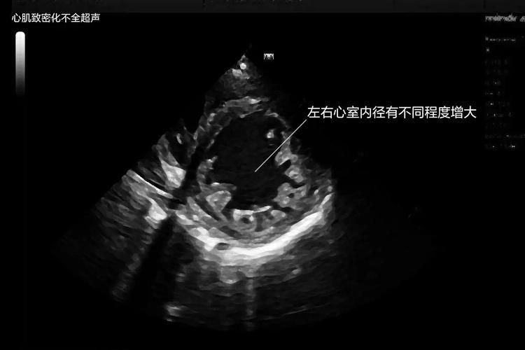 能否給出更多診斷案例,三甲醫院醫療診斷案例“1000字和配圖)能否給出更多診斷案例 龍魚百科 第7張 能否給出更多診斷案例,三甲醫院醫療診斷案例“1000字和配圖)能否給出更多診斷案例 能否給出更多診斷案例,三甲醫院醫療診斷案例“1000字和配圖)能否給出更多診斷案例 龍魚百科 第7張