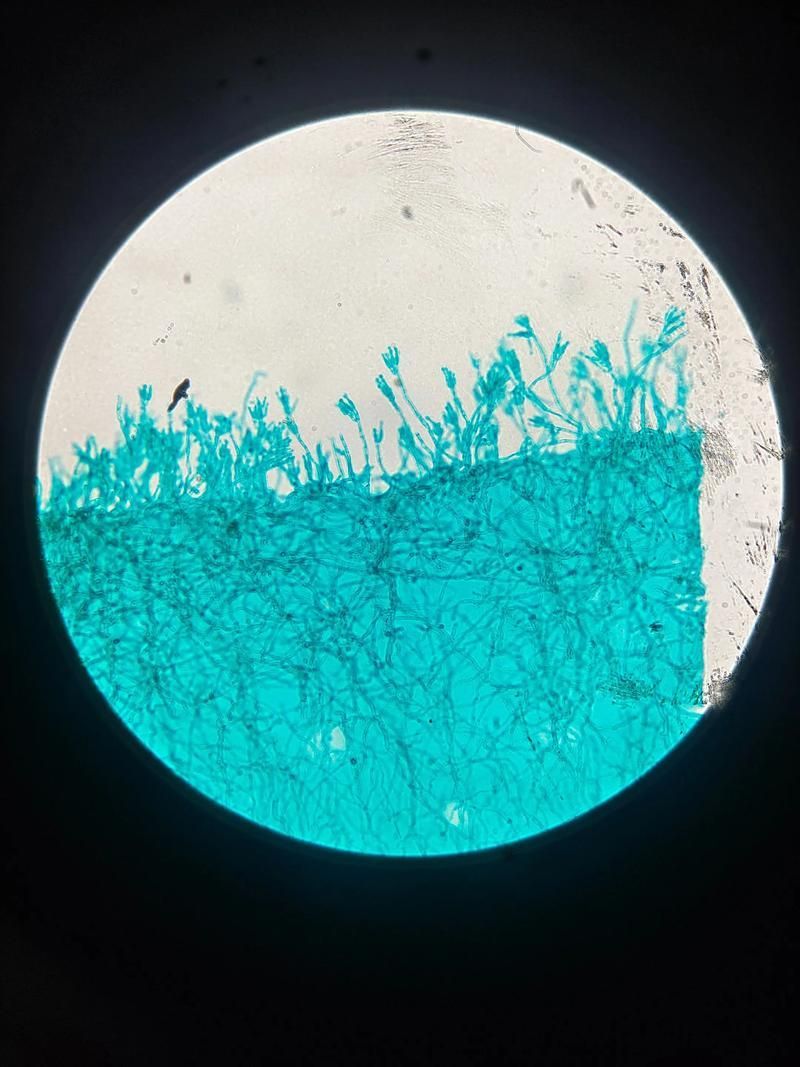 有哪些生物可以控制白色線蟲，富媒體組件庫中雖有多個“白色線蟲”主動召回專業(yè)圖像資源