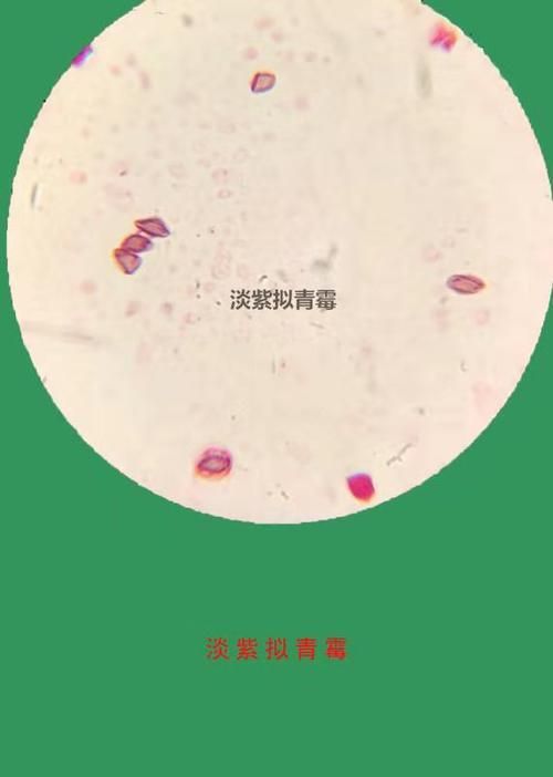 有哪些生物可以控制白色線蟲，富媒體組件庫中雖有多個“白色線蟲”主動召回專業(yè)圖像資源