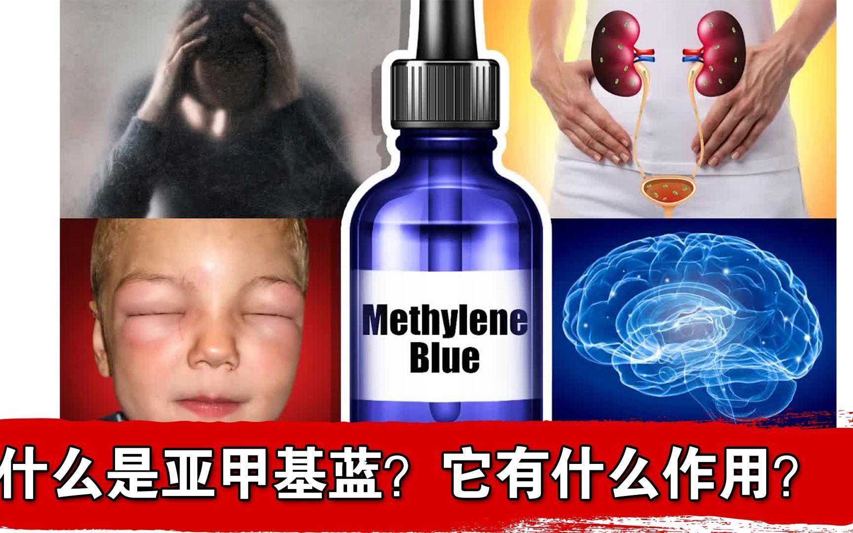 亞甲基藍能治療蒙眼嗎，亞甲基藍能治療蒙眼嗎亞甲基藍治療蒙眼有哪些副作用