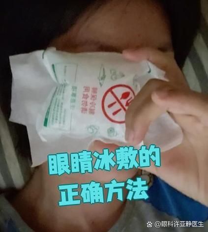 有哪些家庭療法可以緩解魚尾充血