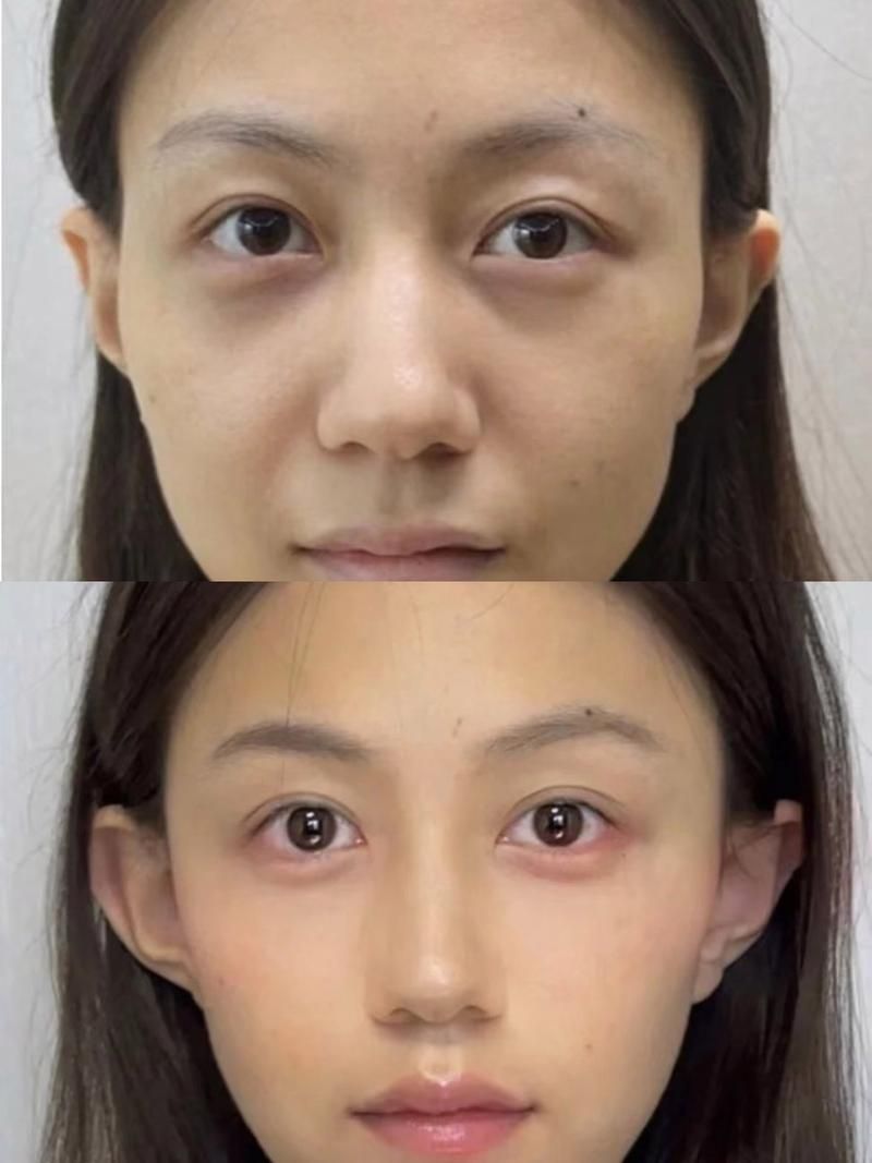 能否提供更詳細的對比圖 能否提供更詳細的對比圖 龍魚百科 第6張
