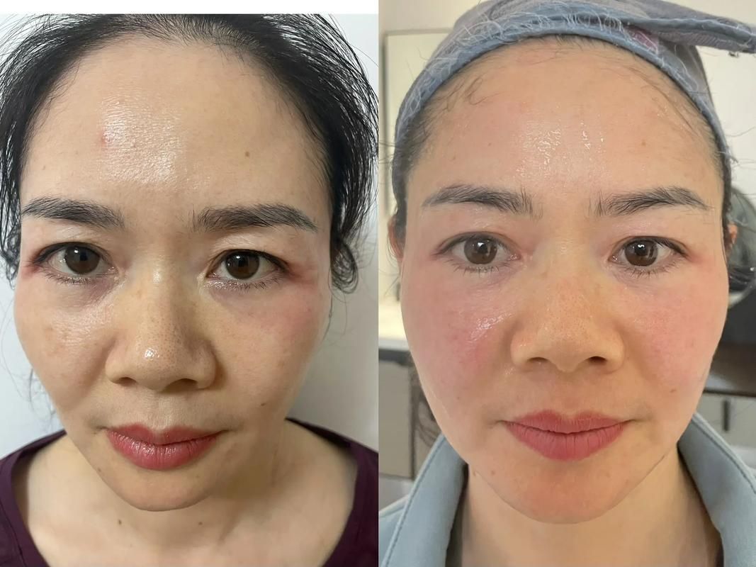 能否提供更詳細的對比圖 能否提供更詳細的對比圖 龍魚百科 第4張