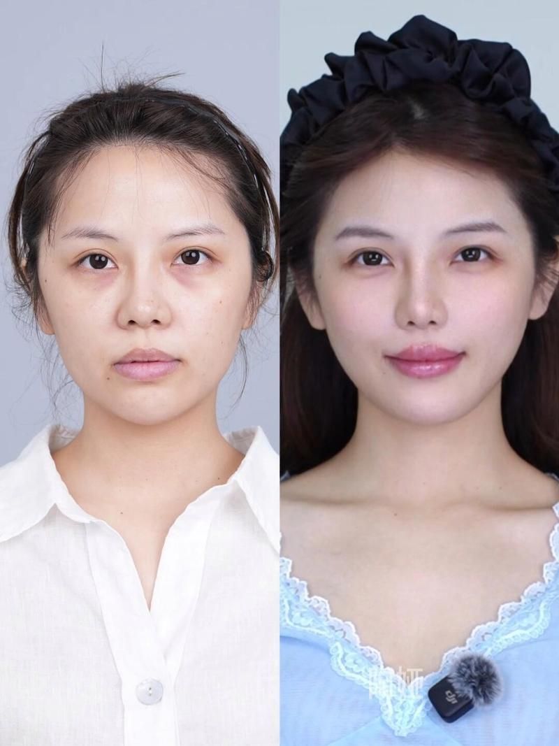 能否提供更詳細的對比圖 能否提供更詳細的對比圖 龍魚百科 第12張