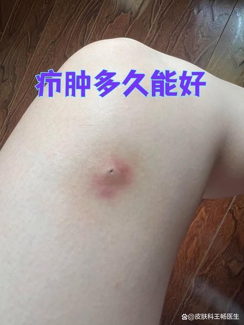如何區分細菌性和真菌性潰爛，如何區分細菌性與真菌性潰爛 如何區分細菌性和真菌性潰爛，如何區分細菌性與真菌性潰爛 龍魚百科 第2張