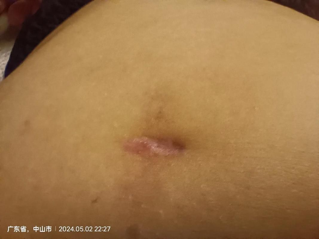 龍魚爛身手術后如何護理
