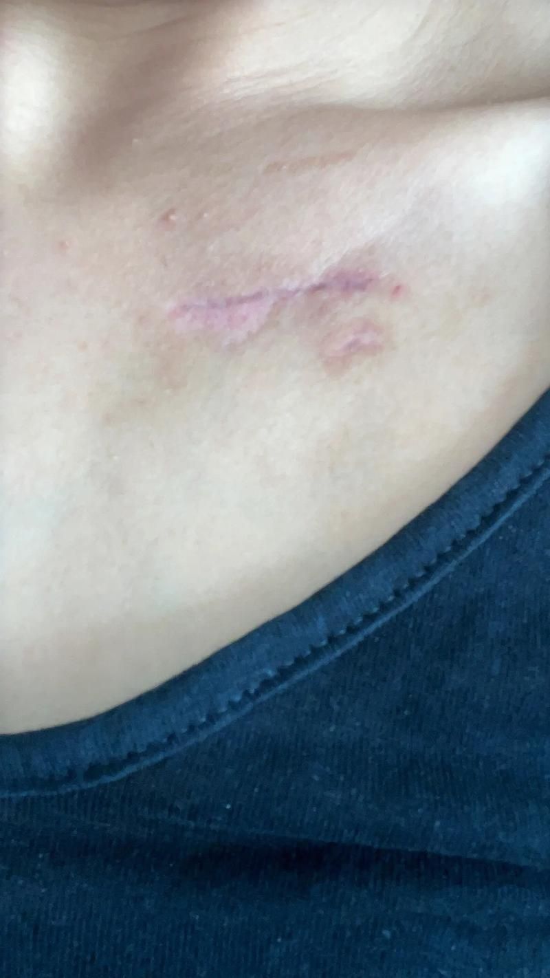 龍魚爛身手術后如何護理