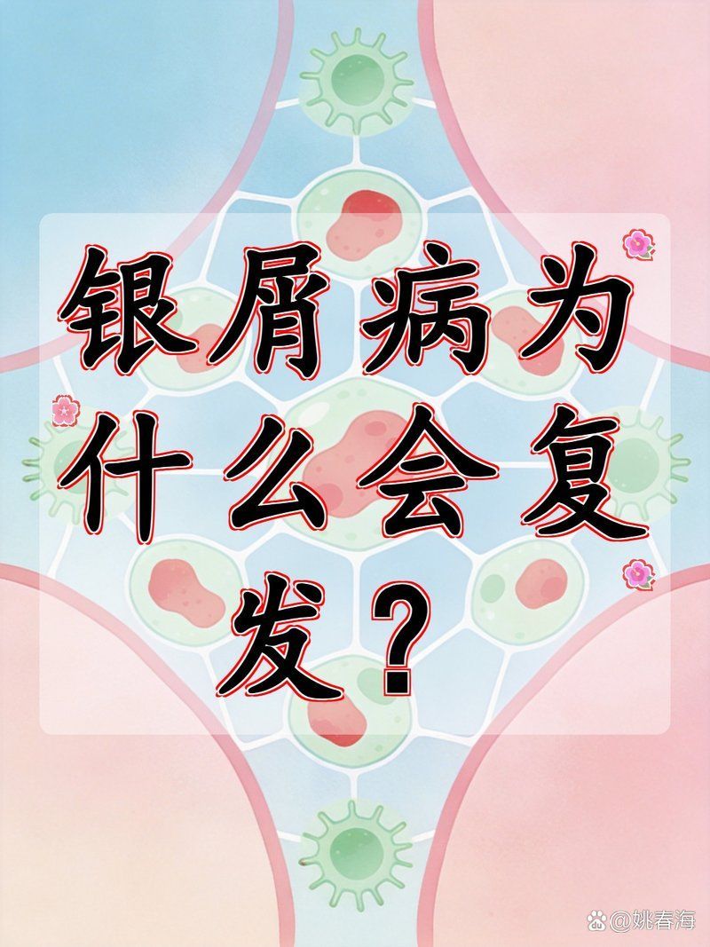 立鱗病復(fù)發(fā)率高嗎，權(quán)威醫(yī)學(xué)文獻(xiàn)與百度健康平臺(tái)的立鱗病復(fù)發(fā)率高嗎