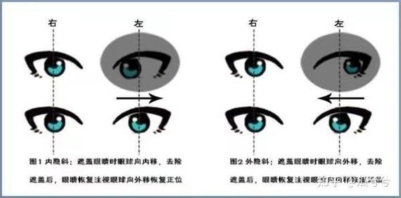 如何判斷蒙眼類型，富媒體組件庫中“蒙眼類型”在多個領域的定義與判斷標準 如何判斷蒙眼類型，富媒體組件庫中“蒙眼類型”在多個領域的定義與判斷標準 龍魚百科 第9張