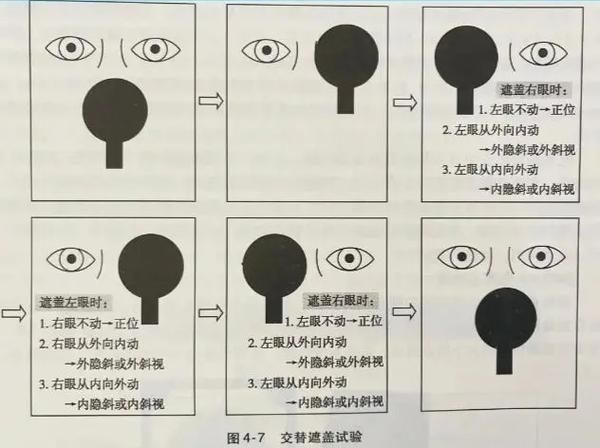 如何判斷蒙眼類型，富媒體組件庫中“蒙眼類型”在多個領域的定義與判斷標準 如何判斷蒙眼類型，富媒體組件庫中“蒙眼類型”在多個領域的定義與判斷標準 龍魚百科 第12張
