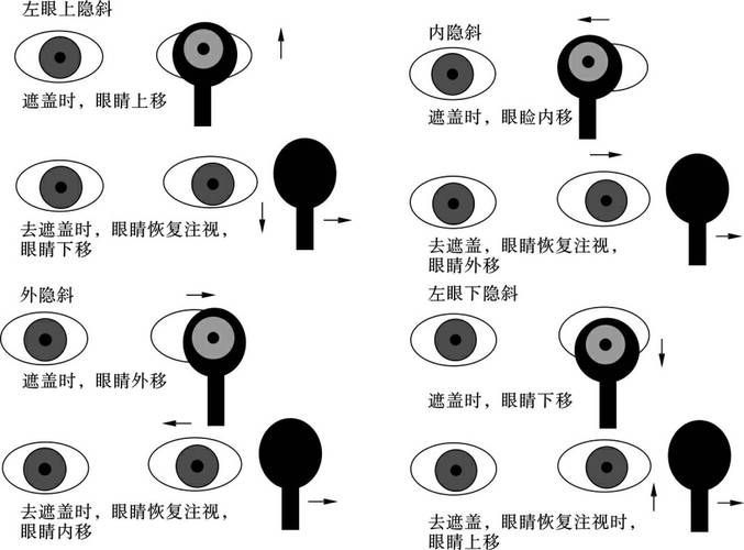 如何判斷蒙眼類型，富媒體組件庫中“蒙眼類型”在多個領域的定義與判斷標準 如何判斷蒙眼類型，富媒體組件庫中“蒙眼類型”在多個領域的定義與判斷標準 龍魚百科 第10張