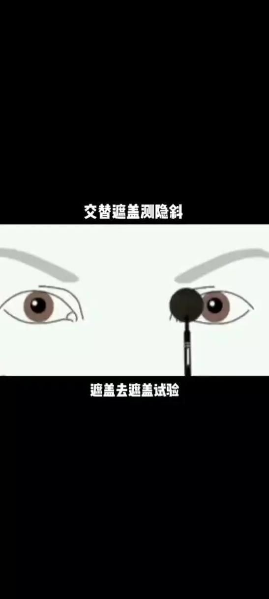 如何判斷蒙眼類型，富媒體組件庫中“蒙眼類型”在多個領域的定義與判斷標準 如何判斷蒙眼類型，富媒體組件庫中“蒙眼類型”在多個領域的定義與判斷標準 龍魚百科 第6張