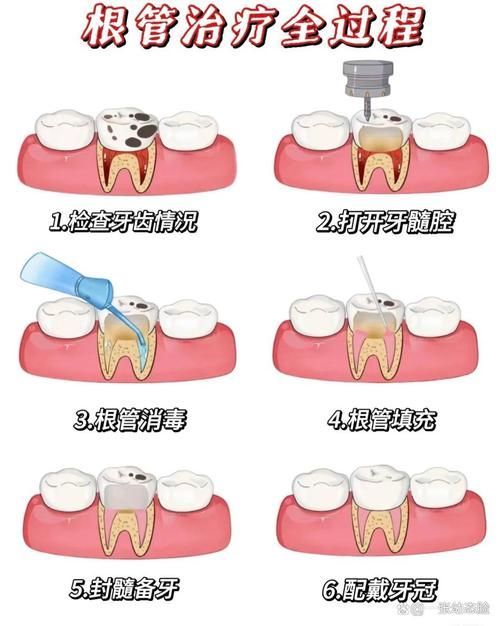 有沒有更詳細的治療步驟，****：治療步驟的治療步驟