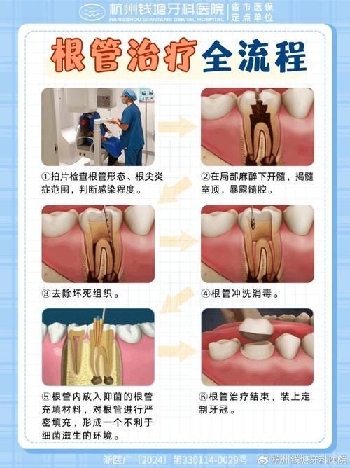 有沒有更詳細的治療步驟，****：治療步驟的治療步驟