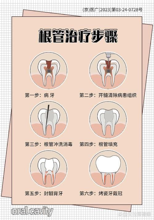 有沒有更詳細的治療步驟，****：治療步驟的治療步驟