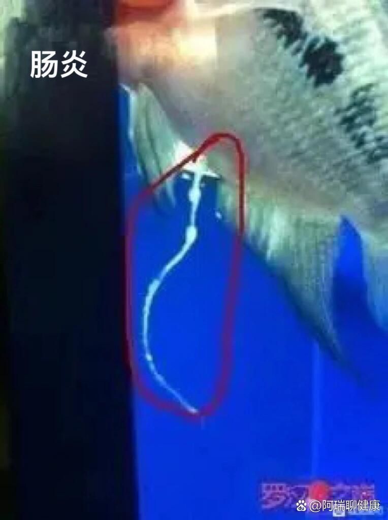 魚腸炎治療期間需要停食嗎