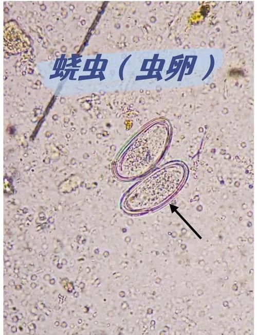 龍魚內寄生蟲有哪些常見種類，arxiv論文助手檢索是否有水產寄生蟲相關的最新研究