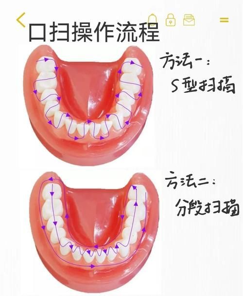 如何預(yù)防傷口感染，中國(guó)手術(shù)預(yù)防傷口感染預(yù)防傷口感染預(yù)防與實(shí)操要點(diǎn)