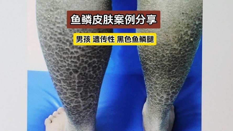 能提供黑身松鱗病的圖片嗎，如何判斷魚是否患有黑身松鱗病