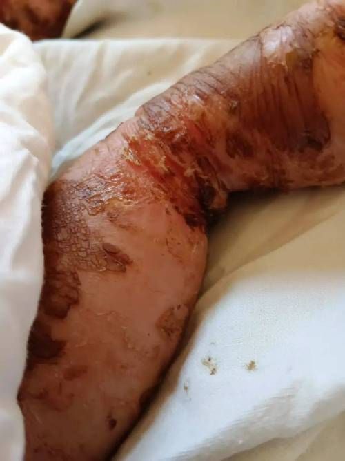 能提供黑身松鱗病的圖片嗎，如何判斷魚是否患有黑身松鱗病