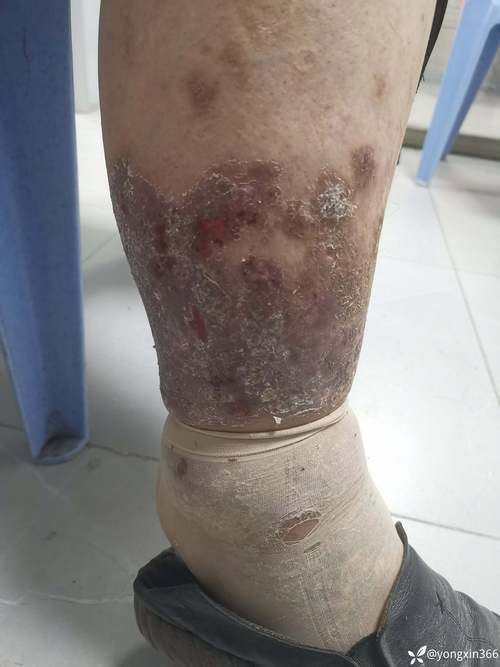 能提供黑身松鱗病的圖片嗎，如何判斷魚是否患有黑身松鱗病