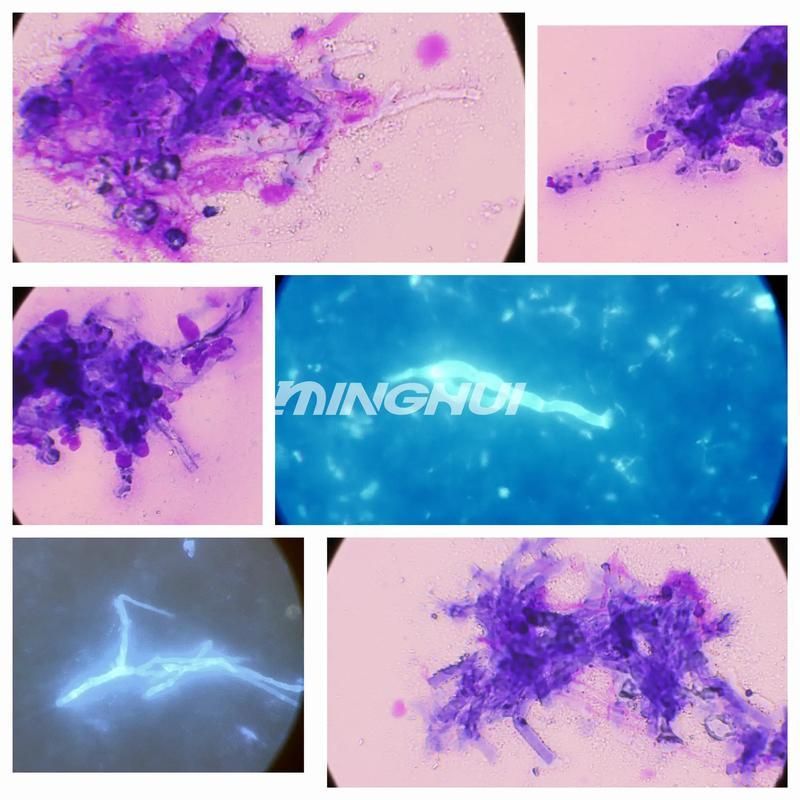 熒光假單胞菌如何檢測，pseudomonasfluorescens熒光假單胞菌檢測方法