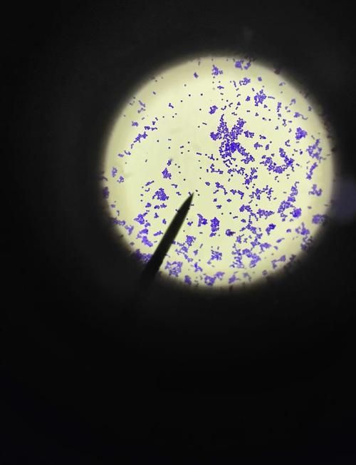 熒光假單胞菌如何檢測，pseudomonasfluorescens熒光假單胞菌檢測方法