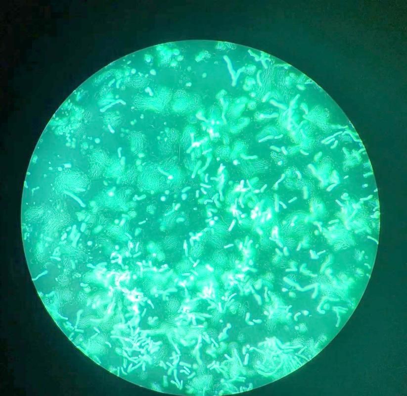 熒光假單胞菌如何檢測，pseudomonasfluorescens熒光假單胞菌檢測方法