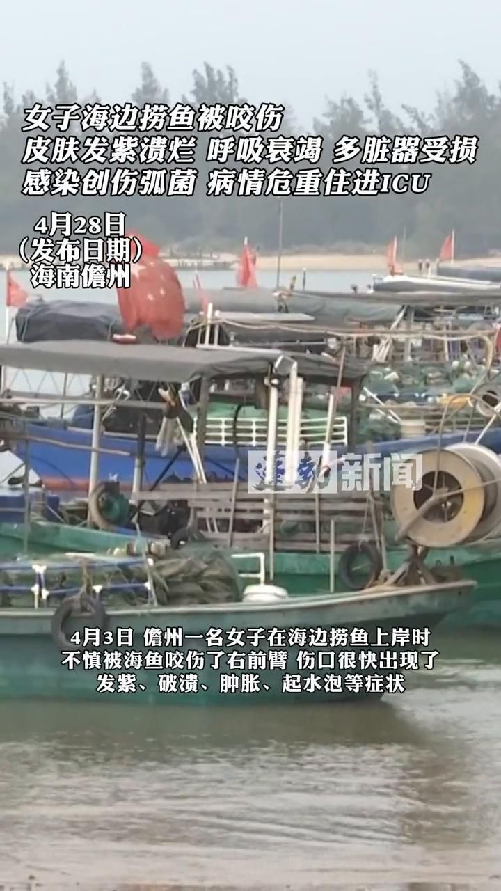 哪種海魚扎傷后感染風(fēng)險(xiǎn)最高
