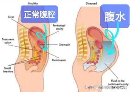 魚腹水如何治療最有效 魚腹水如何治療最有效 龍魚百科 第6張