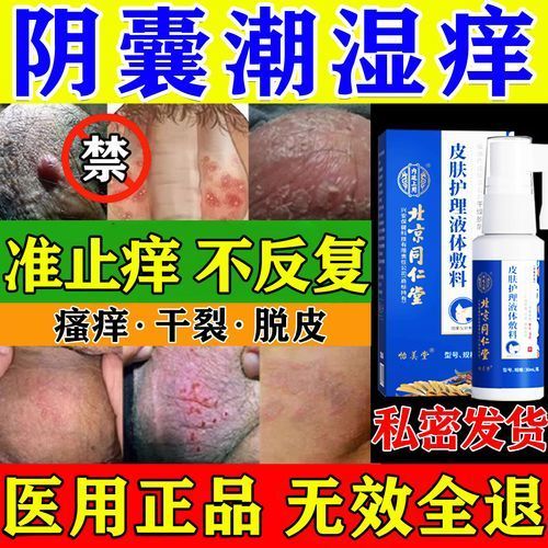 如何判斷魚鱗變紅是否感染,如何判斷魚身紅點成因與治療調全解析 龍魚百科 第6張 如何判斷魚鱗變紅是否感染,如何判斷魚身紅點成因與治療調全解析 如何判斷魚鱗變紅是否感染,如何判斷魚身紅點成因與治療調全解析 龍魚百科 第6張