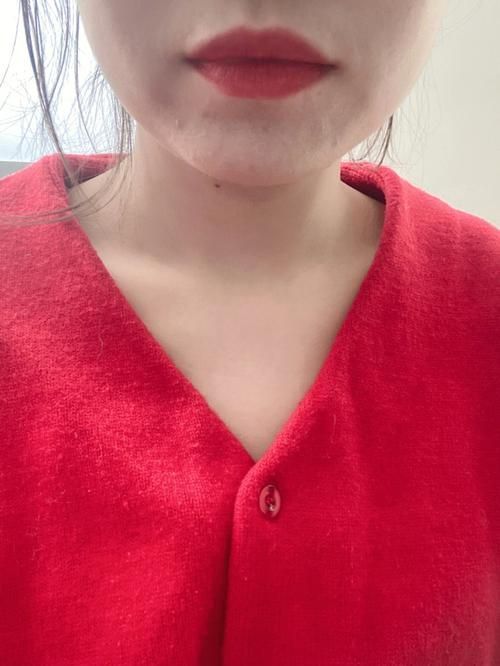 如何判斷中毒程度,如何判斷中毒程度思考完成百度健康-去問診 龍魚百科 第3張 如何判斷中毒程度,如何判斷中毒程度思考完成百度健康-去問診 如何判斷中毒程度,如何判斷中毒程度思考完成百度健康-去問診 龍魚百科 第3張
