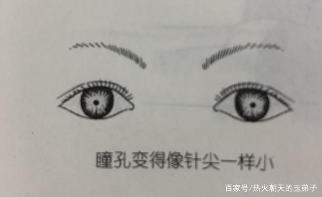 如何判斷中毒程度,如何判斷中毒程度思考完成百度健康-去問診 龍魚百科 第8張 如何判斷中毒程度,如何判斷中毒程度思考完成百度健康-去問診 如何判斷中毒程度,如何判斷中毒程度思考完成百度健康-去問診 龍魚百科 第8張