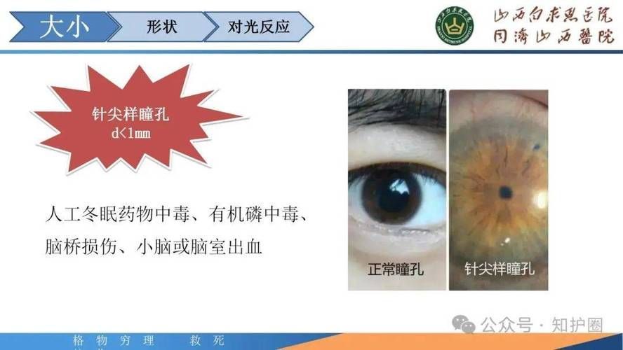 如何判斷中毒程度,如何判斷中毒程度思考完成百度健康-去問診 龍魚百科 第9張 如何判斷中毒程度,如何判斷中毒程度思考完成百度健康-去問診 如何判斷中毒程度,如何判斷中毒程度思考完成百度健康-去問診 龍魚百科 第9張