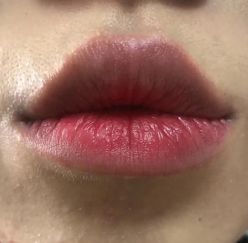 如何判斷中毒程度,如何判斷中毒程度思考完成百度健康-去問診 龍魚百科 第1張 如何判斷中毒程度,如何判斷中毒程度思考完成百度健康-去問診 如何判斷中毒程度,如何判斷中毒程度思考完成百度健康-去問診 龍魚百科 第1張