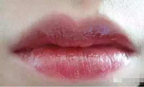 如何判斷中毒程度,如何判斷中毒程度思考完成百度健康-去問診 龍魚百科 第2張 如何判斷中毒程度,如何判斷中毒程度思考完成百度健康-去問診 如何判斷中毒程度,如何判斷中毒程度思考完成百度健康-去問診 龍魚百科 第2張