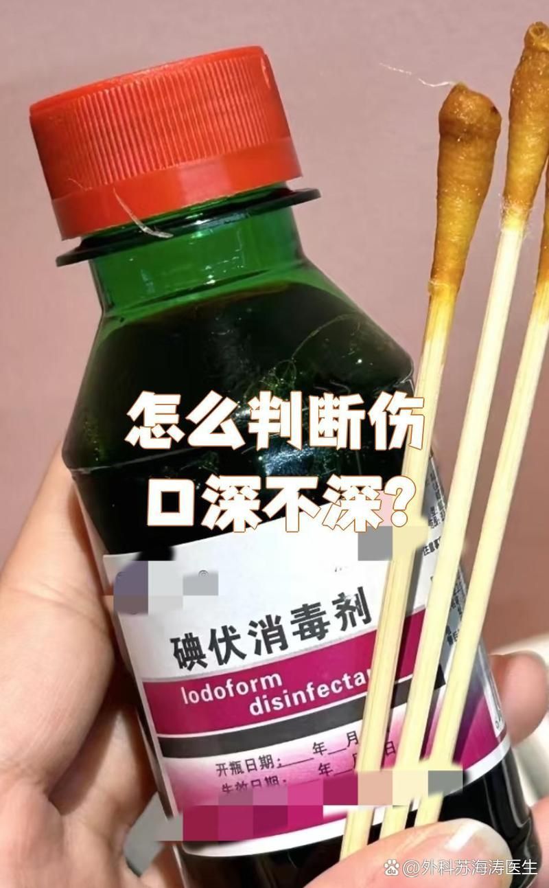 如何判斷傷口是否深，判斷傷口是否深需要綜合考慮多個因素以下關鍵步驟和考慮因素 如何判斷傷口是否深，判斷傷口是否深需要綜合考慮多個因素以下關鍵步驟和考慮因素 龍魚百科 第1張