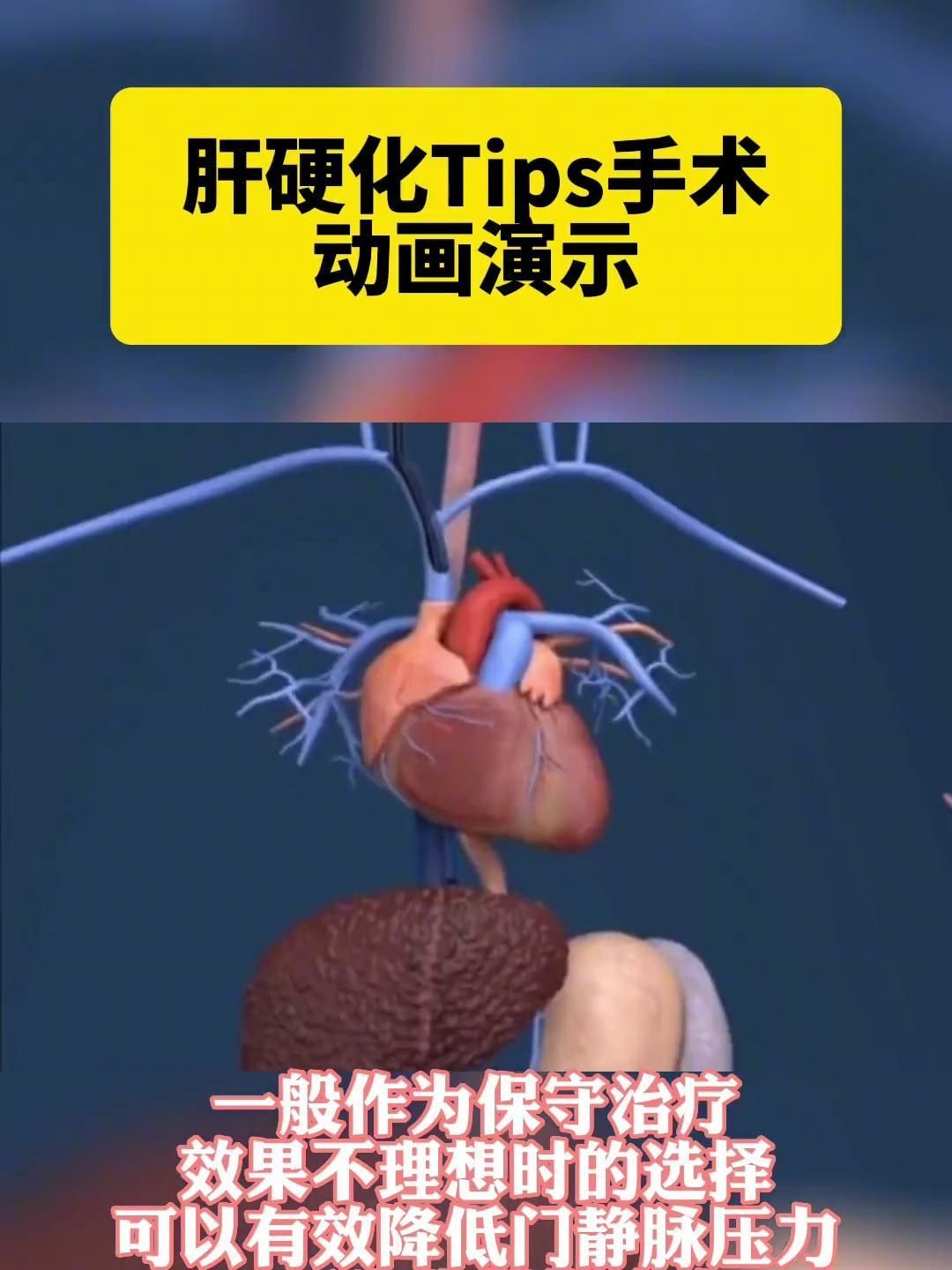 腹水病有哪些治療方法，腹水病治療方案 腹水病有哪些治療方法，腹水病治療方案 龍魚百科 第3張