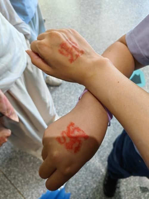 如何判斷龍魚撞傷是否嚴(yán)重? 龍魚百科 第6張 如何判斷龍魚撞傷是否嚴(yán)重? 如何判斷龍魚撞傷是否嚴(yán)重? 龍魚百科 第6張
