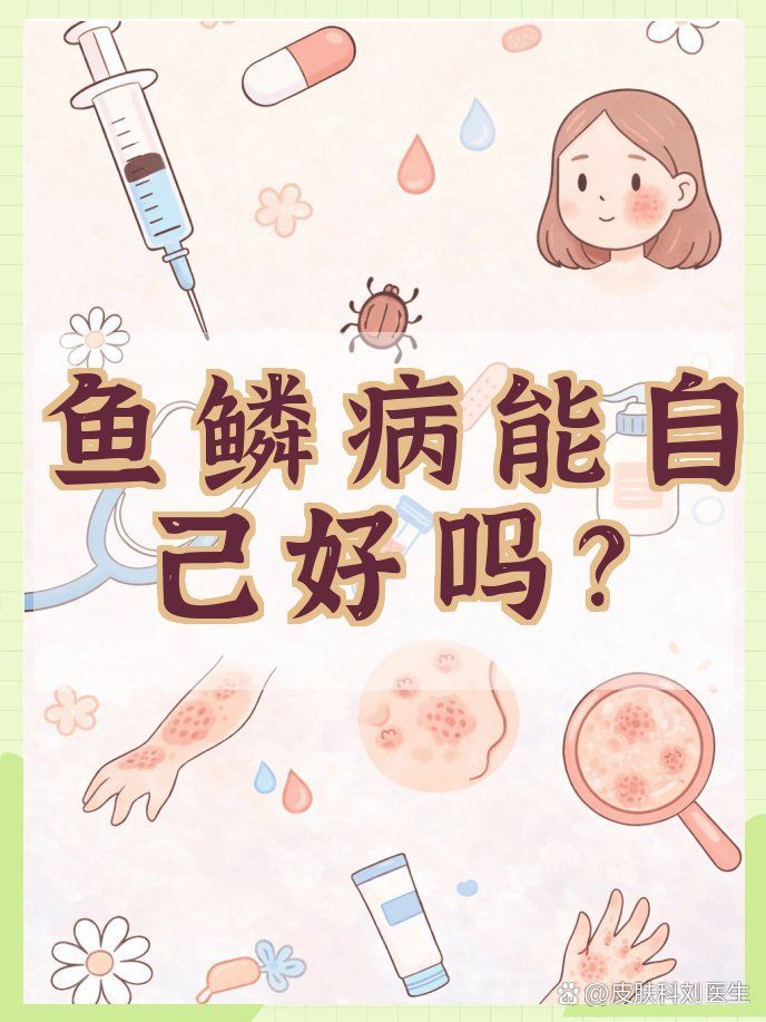 魚鱗皮膚病可以自愈嗎，魚鱗病可以自愈嗎 魚鱗皮膚病可以自愈嗎，魚鱗病可以自愈嗎 龍魚百科 第1張