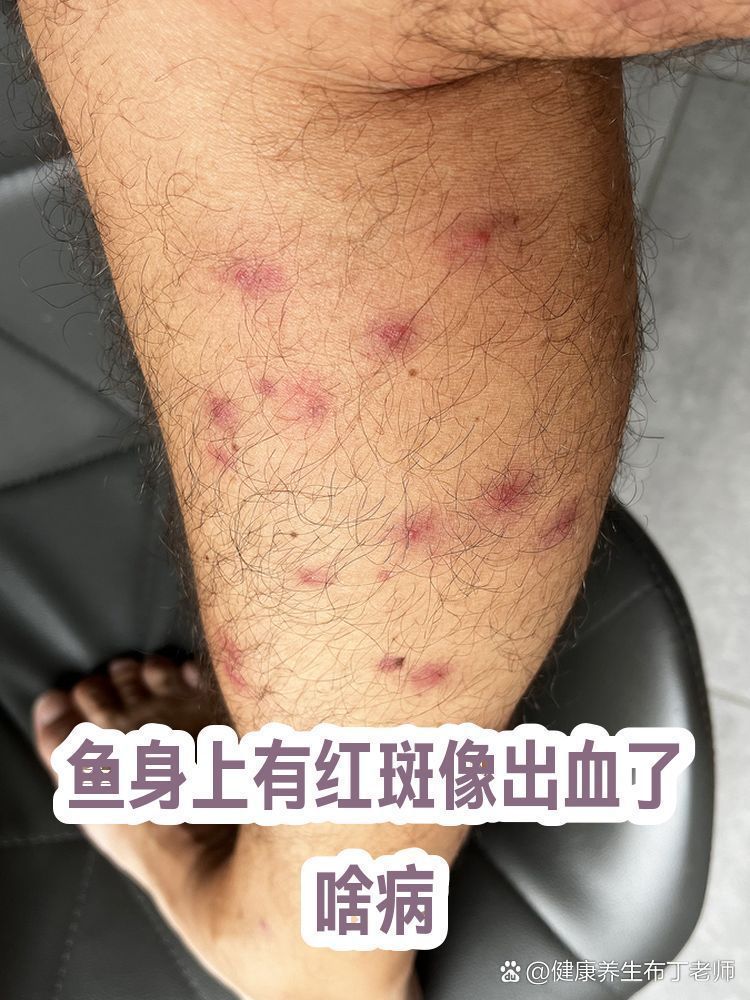 如何預防魚身紅斑，如何科學預防魚身紅斑 如何預防魚身紅斑，如何科學預防魚身紅斑 龍魚百科 第7張