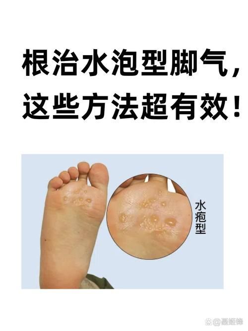如何判斷自己是否感染了真菌或細菌,mcp工具“百度健康-去問診”可輔助獲取癥狀分析模型 龍魚百科 第3張 如何判斷自己是否感染了真菌或細菌,mcp工具“百度健康-去問診”可輔助獲取癥狀分析模型 如何判斷自己是否感染了真菌或細菌,mcp工具“百度健康-去問診”可輔助獲取癥狀分析模型 龍魚百科 第3張