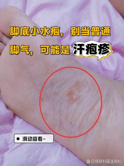 如何判斷自己是否感染了真菌或細菌,mcp工具“百度健康-去問診”可輔助獲取癥狀分析模型 龍魚百科 第5張 如何判斷自己是否感染了真菌或細菌,mcp工具“百度健康-去問診”可輔助獲取癥狀分析模型 如何判斷自己是否感染了真菌或細菌,mcp工具“百度健康-去問診”可輔助獲取癥狀分析模型 龍魚百科 第5張