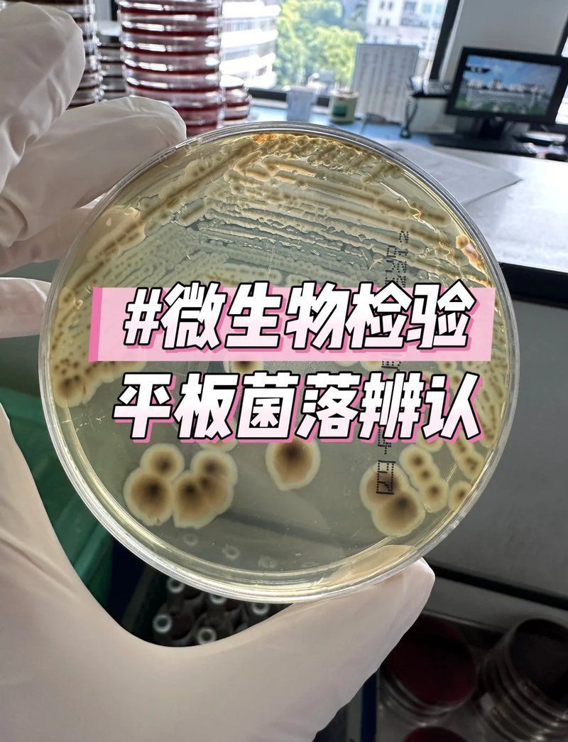 如何區分細菌和真菌的菌落特征，細菌和真菌的菌落特征