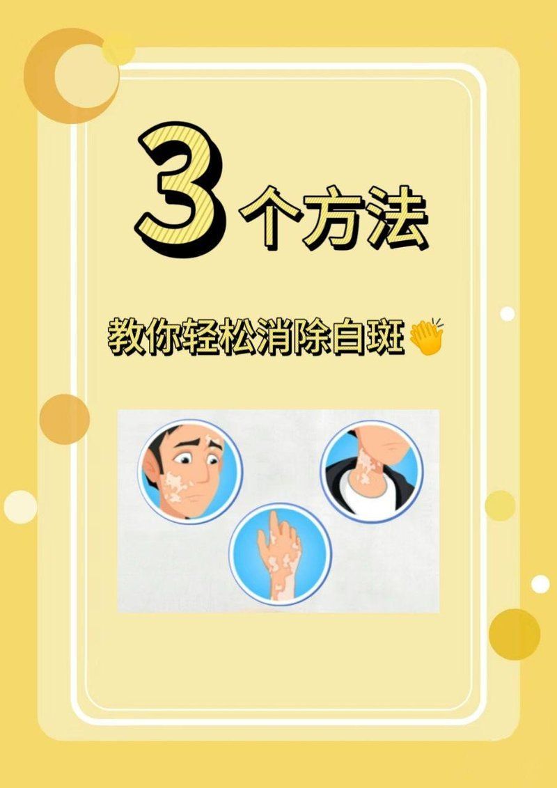 有哪些有效的白點病治療方法，3個方法，教你輕松消除白斑