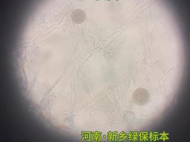 病理性黑霉的治療效果如何,病理性黑霉的治療效果詳解病理性黑霉治療效果詳解 龍魚百科 第5張 病理性黑霉的治療效果如何,病理性黑霉的治療效果詳解病理性黑霉治療效果詳解 病理性黑霉的治療效果如何,病理性黑霉的治療效果詳解病理性黑霉治療效果詳解 龍魚百科 第5張