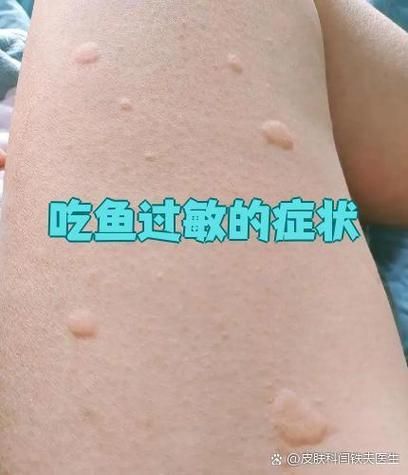 如何緩解魚頭充血癥狀，如何緩解魚頭充血