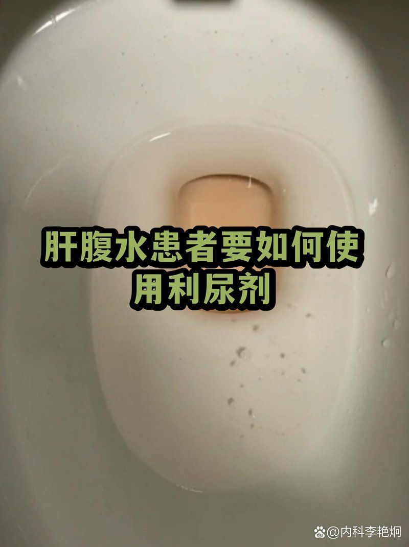 如何正確使用利尿劑排腹水