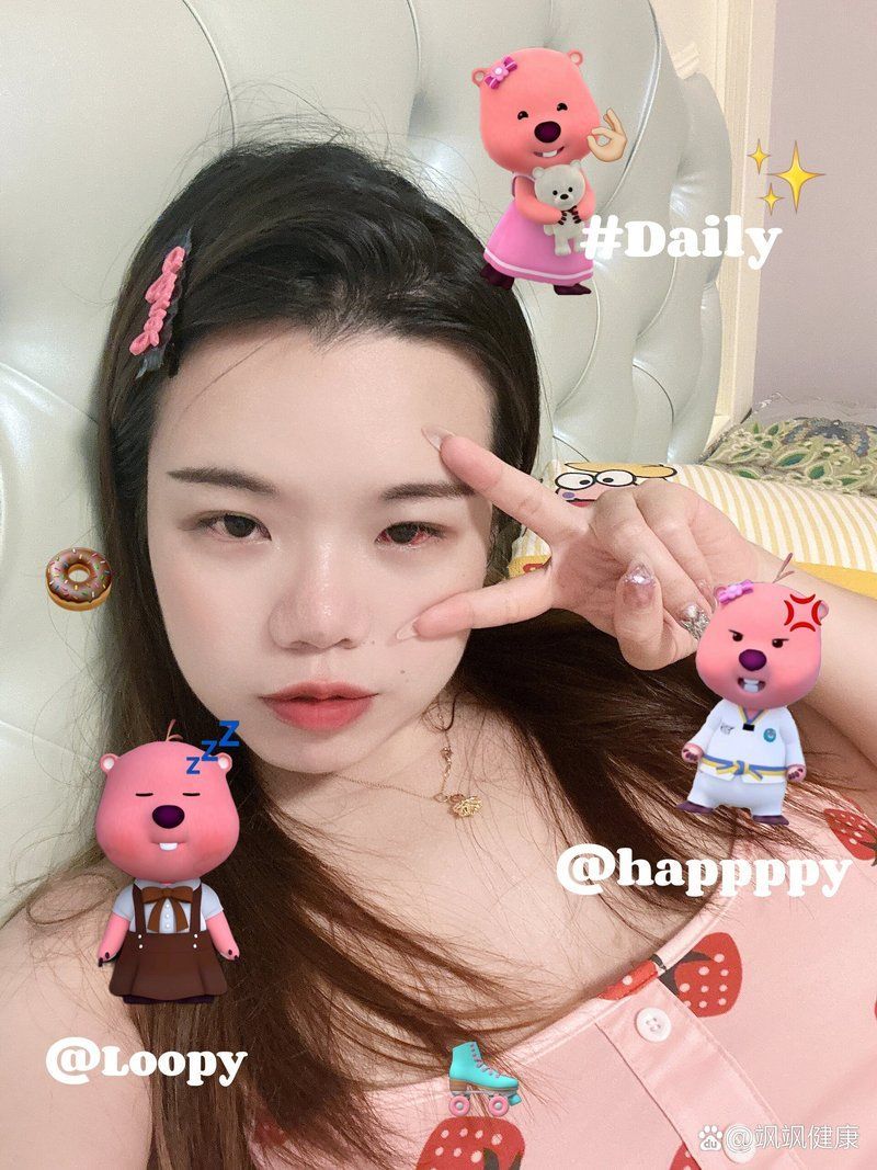 土霉素治療蒙眼病需要多久見效，土霉素治療權威醫學圖譜 土霉素治療蒙眼病需要多久見效，土霉素治療權威醫學圖譜 龍魚百科 第7張