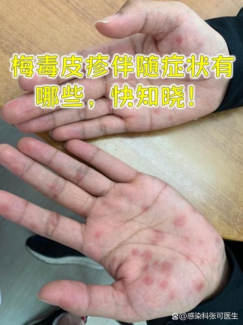 能否提供更多早期癥狀的圖片，早期癥狀的識別與分析